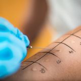 Wie kann der Arzt Heuschnupfen feststellen?