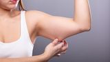 Der Sommer kommt, die Ärmel werden kürzer – und legen vor allem bei Frauen die sogenannten Winkearme frei. Das ist der Hautlappen unterhalb des Bizepses, der jeder Armbewegung "nachwinkt". Winkearme entstehen, wenn es ein Missverhältnis zwischen Haut-Wachstum und der darunterliegenden Muskulatur gibt. Die Schwerkraft tut ihr übriges: Sie zieht an der Haut und löst sie leicht von den Muskeln. Wenn wir die Arme hochhalten,  Eine klassische Übung: die Dips. Dafür mit den Händen auf einer Stuhlkante abstützen und den Po langsam Richtung Boden absenken und wieder nach oben drücken. Im Fitnessstudio gibt es auch sogenannte Dip-Maschinen, an denen sich die Oberarme gezielt trainieren lassen. Gut geeignet sind auch Stütz-Übungen auf einer Power-Plate oder gezielte Stimulation über EMS-Training (Training durch Elektrostimulation).  Sinnvoll ist eine Anzahl von 10 bis 15 Wiederholungen. Bei der letzten Wiederholung sollte der Muskel wirklich leer sein. Dann eine kurze Pause von zwei Minuten einlegen und das Set zwei bis drei Mal wiederholen. Wer auf diese Weise jeden zweiten Tag trainiert, wird schnell erste Erfolge sehen. Ziel ist der Aufbau von Muskelvolumen. Damit das gelingt, müssen wir die Muskulatur der Oberarme energetisch ausbelasten, sie also maximal ermüden, sodass man das Gefühl bekommt: 'Eine weitere Wiederholung der Übung schaffe ich nicht mehr.'