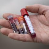 Blutproben von einem Löwen