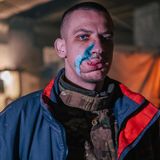 Im Gesicht verwundeter Soldat