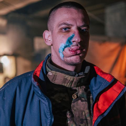 Im Gesicht verwundeter Soldat