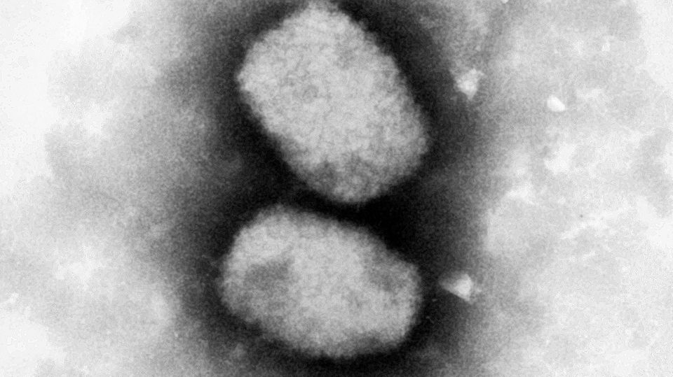 Diese vom Robert Koch-Institut (RKI) zur Verfügung gestellte elektronenmikroskopische Aufnahme zeigt das Affenpockenvirus