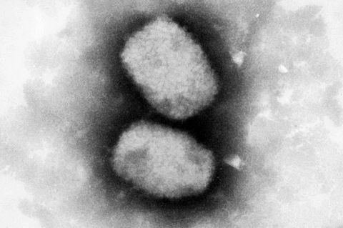 Diese vom Robert Koch-Institut (RKI) zur Verfügung gestellte elektronenmikroskopische Aufnahme zeigt das Affenpockenvirus