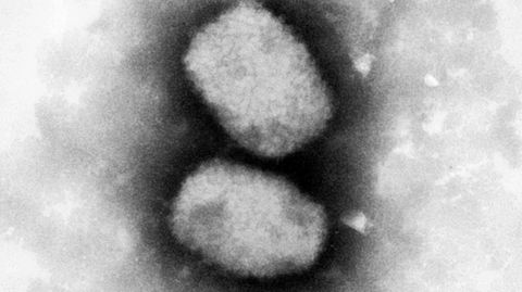 Diese vom Robert-Koch-Institut (RKI) zur Verfügung gestellte elektronenmikroskopische Aufnahme zeigt das Affenpockenvirus