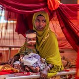 Eine junge Äthiopierin mit ihrem unterernährten Kind