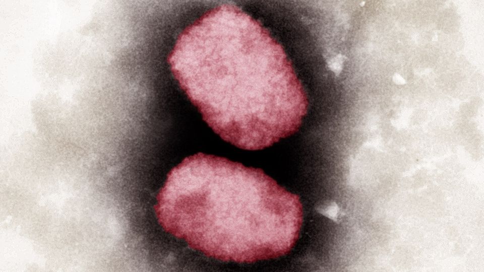 Elektronenmikroskopische Aufnahme von Affenpocken-Viren