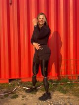 Angie Berbuer verlor beide Beine – und ist glücklich wie nie | STERN.de