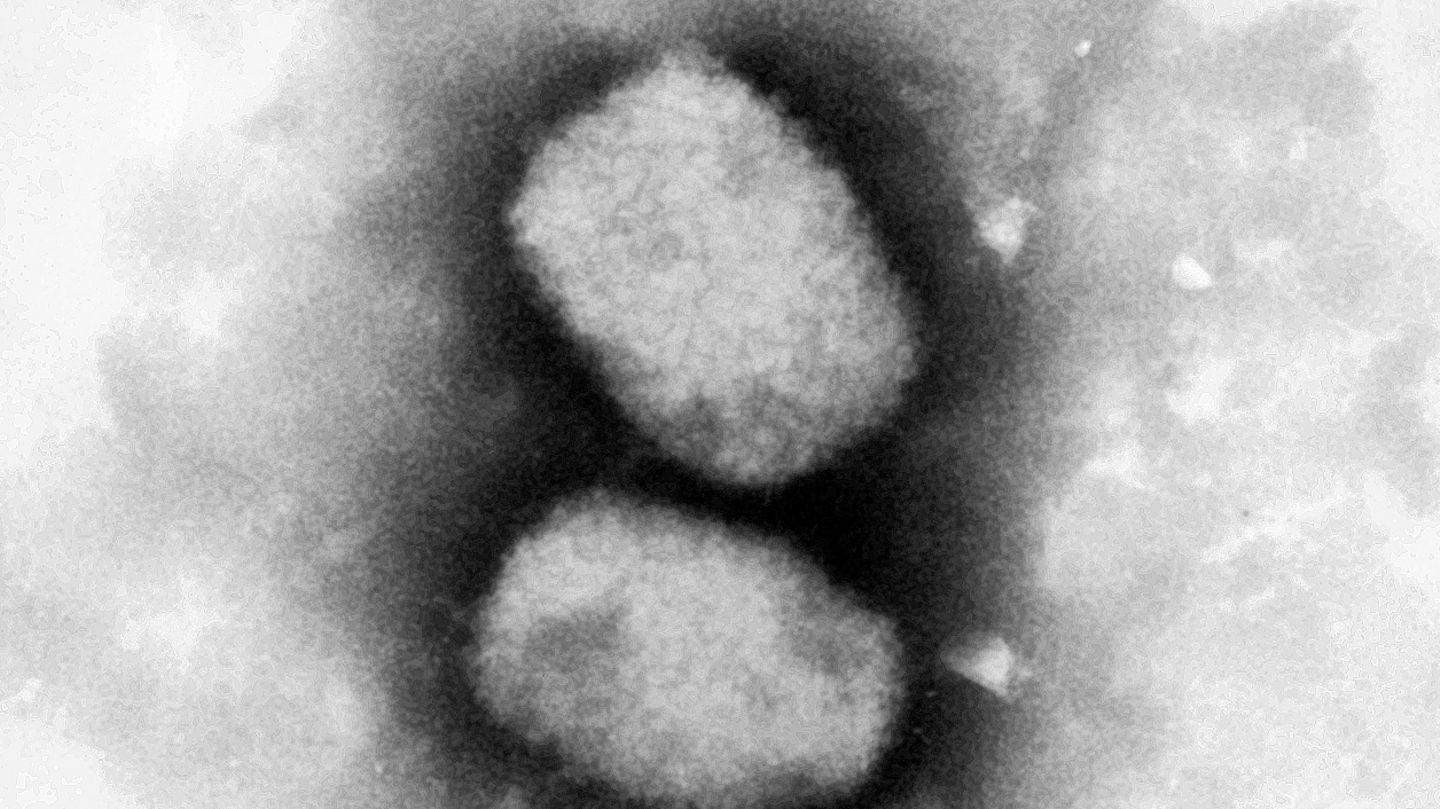 Monkeypox: Vaccination should only take place in isolated cases
