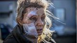 Schwer gezeichnet steht eine verletzte Frau vor einem Krankenhaus in Tschuhujiw.