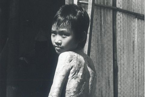 Napalm-Mädchen