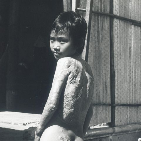Napalm-Mädchen