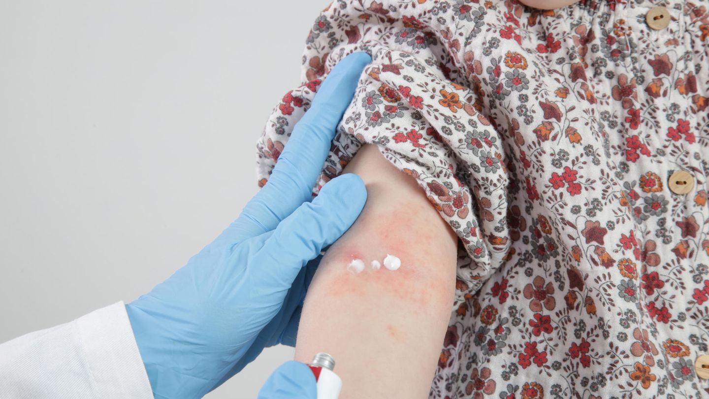 Antihistaminika-Cremes