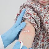 Antihistaminika-Cremes