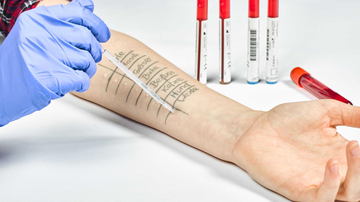 Hyposensibilisierung