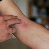 Ciclosporin-Tabletten