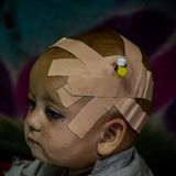 Ein afghanisches Kind wird in einem Krankenhaus in der Stadt Sharan behandelt