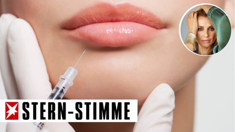Instagram begünstigt die zunehmende Verbreitung aufgespritzter Lippen