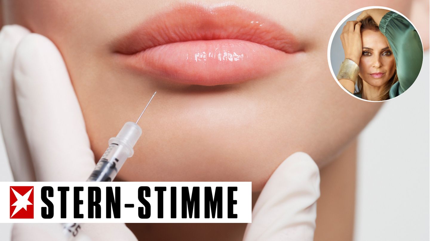 Instagram begünstigt die zunehmende Verbreitung aufgespritzter Lippen