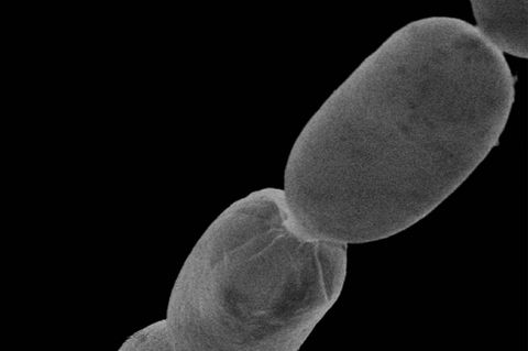 Das Bakterium Thiomargarita magnifica unter dem Mikroskop