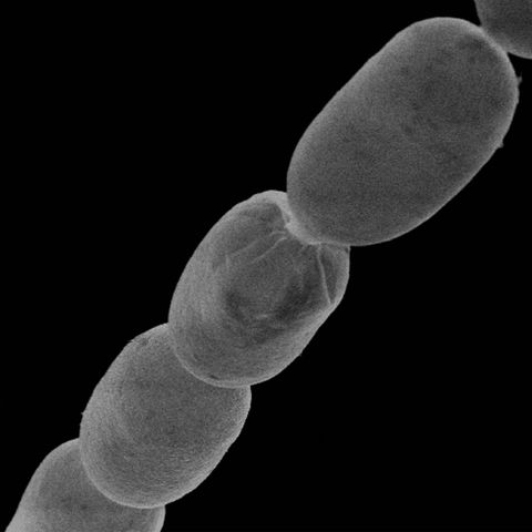 Das Bakterium Thiomargarita magnifica unter dem Mikroskop
