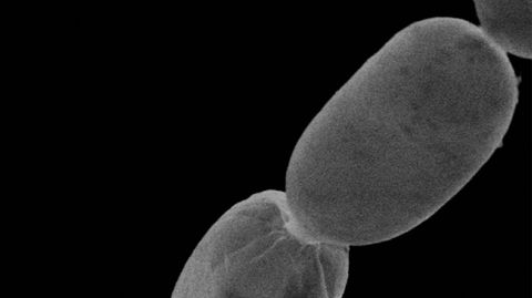 Das Bakterium Thiomargarita magnifica unter dem Mikroskop
