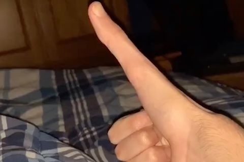 Virales Video: 13 Zentimeter lang: Mann mit "E.T."–Daumen erstaunt das Internet