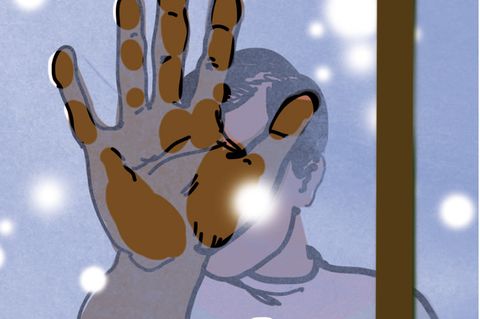 Illustration Diagnose: Gebräunte Handinnenflächen