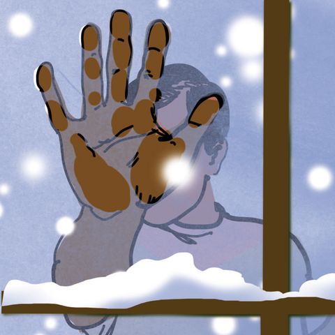Illustration Diagnose: Gebräunte Handinnenflächen