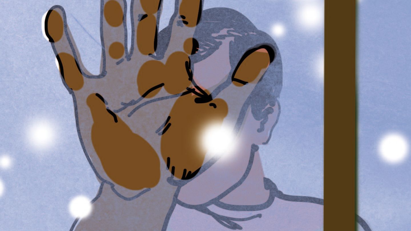 Illustration der wöchentlichen Kolumne »Diagnose« 2022 (FINAL) Addisson_Schlosser Illustration Diagnose: Gebräunte Handinnenflächen