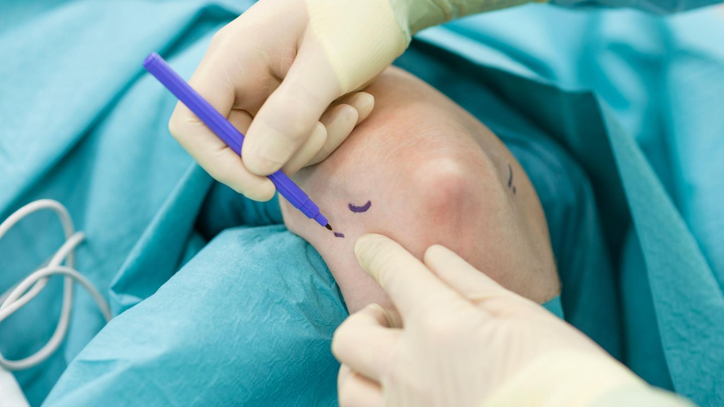 Schulter- und Ellenbogenchirurgie