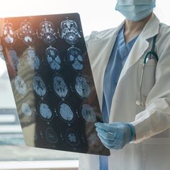 Ein Arzt mit Gehirnscans eines Schlaganfall-Patienten