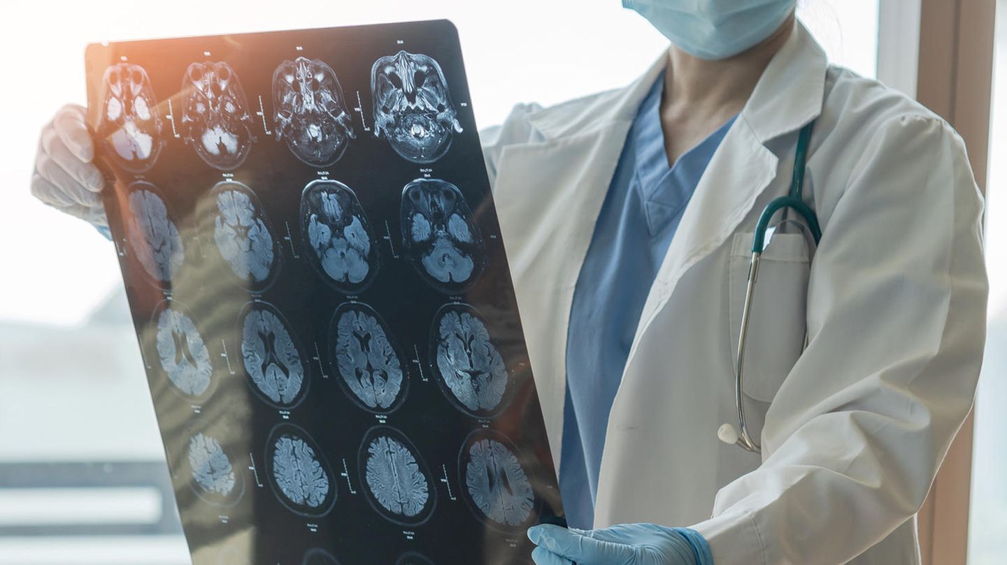 Ein Arzt mit Gehirnscans eines Schlaganfall-Patienten