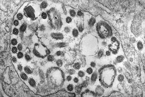Marburg-Virus
