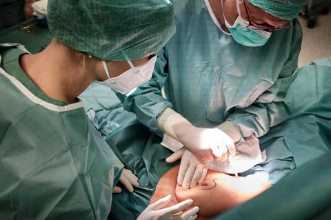 Brustkrebs-Operation: Entfernung eines Mammakarzinoms