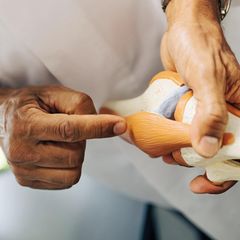 Ein Arzt mit einem Kniemodell