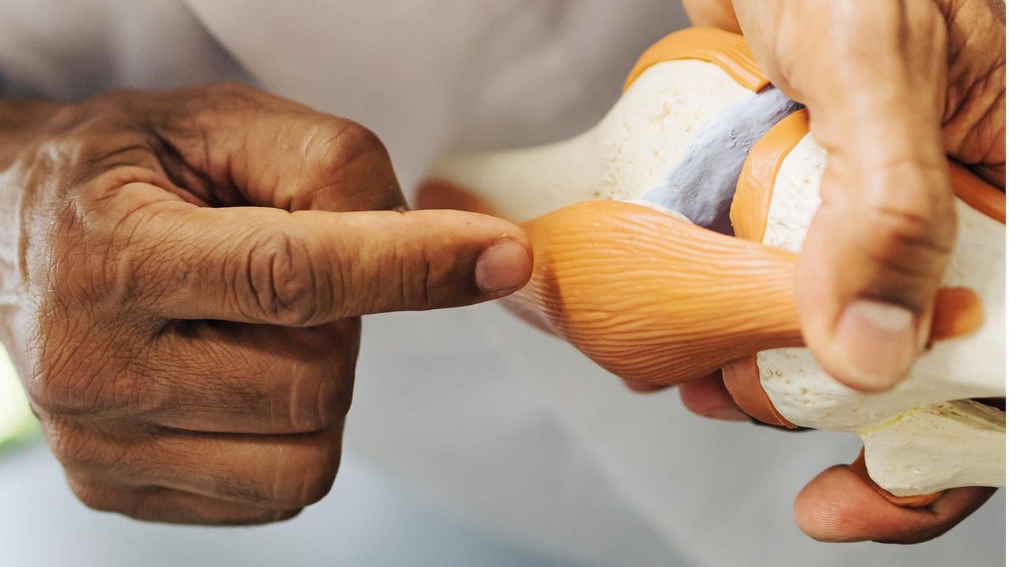 Ein Arzt mit einem Kniemodell