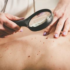 Dermatologe untersucht die Haut eines Patienten