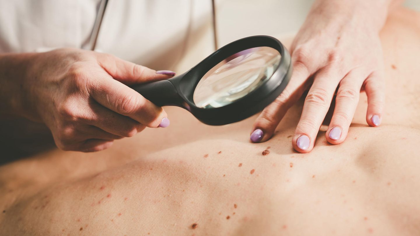 Dermatologe untersucht die Haut eines Patienten