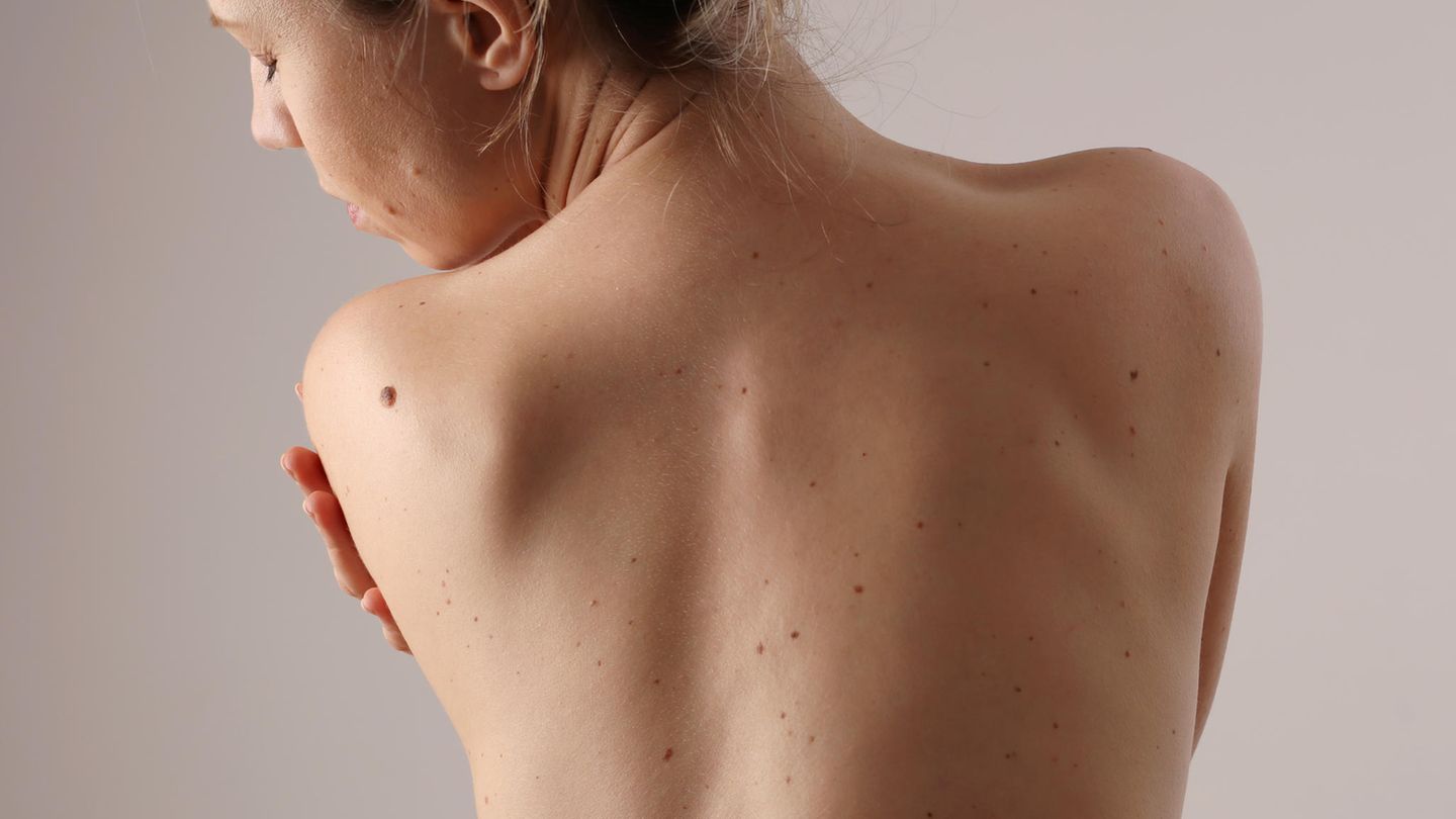 Haut: Das sind empfehlenswerte Kliniken aus dem Bereich