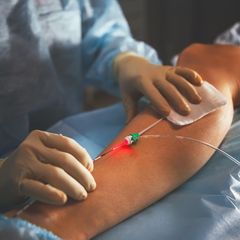 Gefäßchirurgie