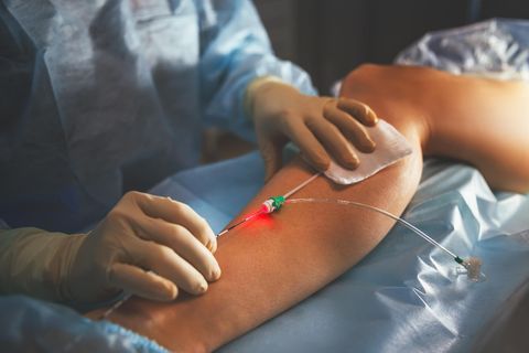Gefäßchirurgie