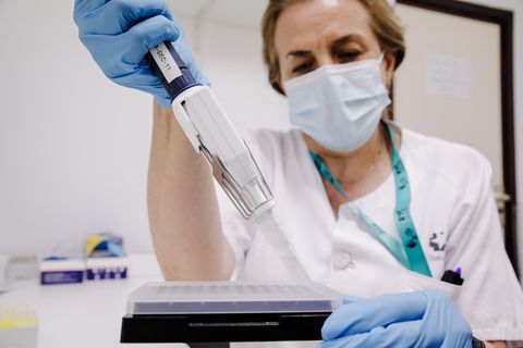 Eine Krankenschwester bereitet in einem Madrider Krankenhaus einen PCR-Tests zur Erkennung des Affenpockenvirus vor