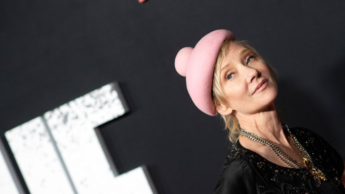 Anne Heche: Actress is in a coma after a fire accident