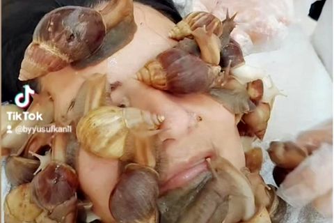 Kosmetikbehandlung: Schönheitssalon setzt auf Schnecken als Gesichtsmaske