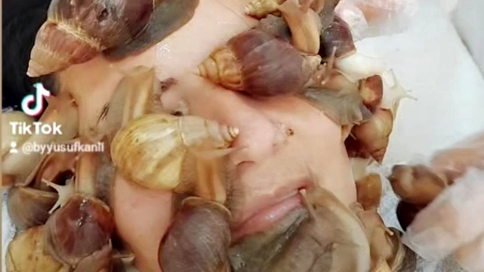 Kosmetikbehandlung: Schönheitssalon setzt auf Schnecken als Gesichtsmaske Kosmetikbehandlung: Schönheitssalon setzt auf Schnecken als Gesichtsmaske