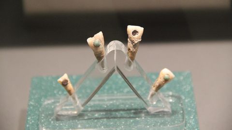 Verzierte Maya-Zähne aus einer archäologischen Ausgrabung
