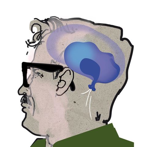 Diagnose Illustration HerzdemenzIllustration Herzdemenz