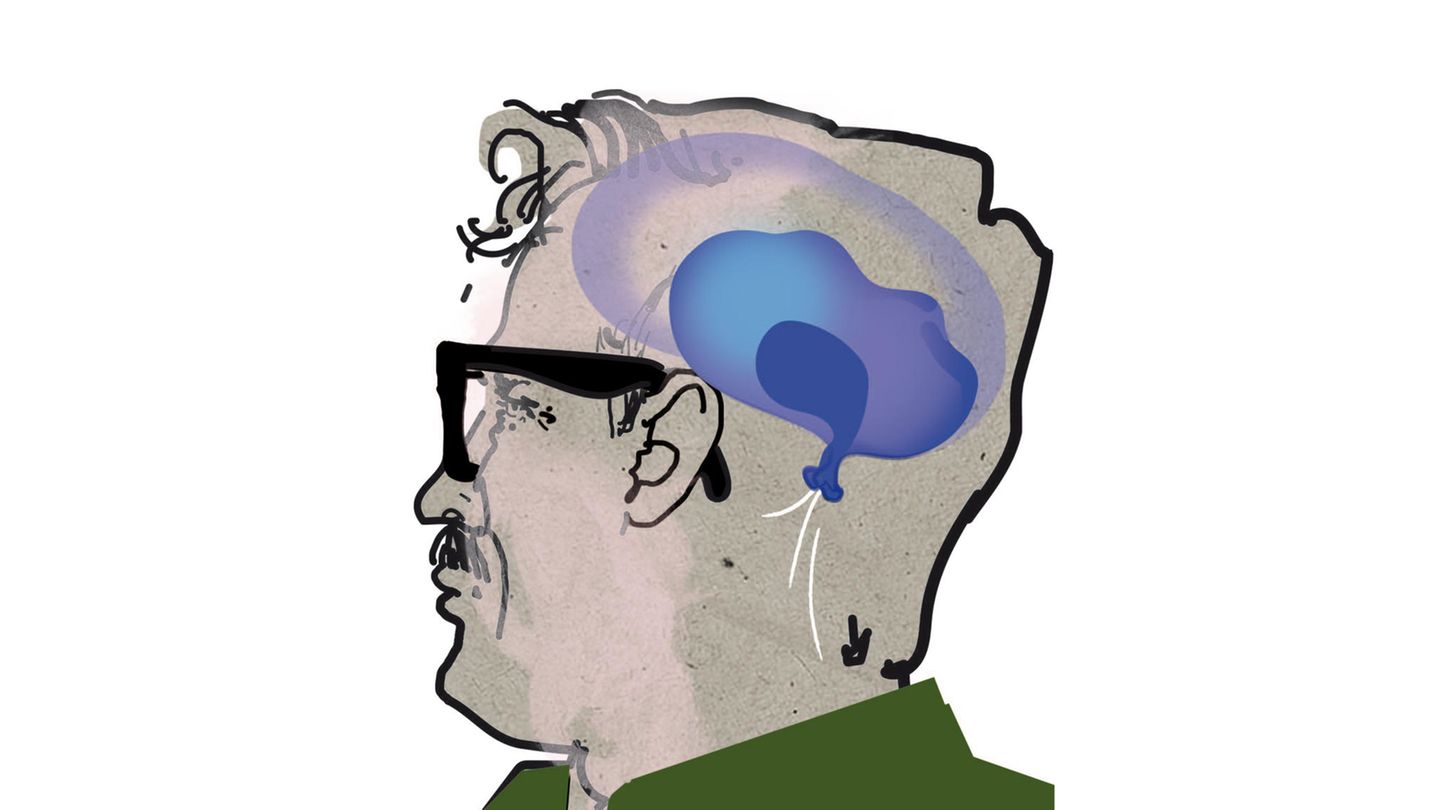 The diagnosis: What is behind the supposed dementia? - 24 Hours World