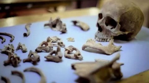 Einige der in Norwich gefundenen Menschenknochen