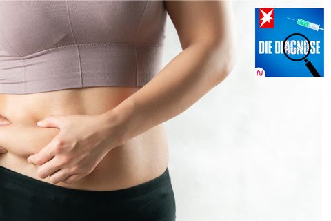 Frau mit erhöhten Zuckerwerten